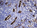 TSPAN7 Antibody in Immunohistochemistry (Paraffin) (IHC (P))