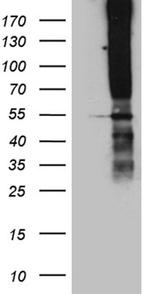 TSPAN7 Antibody in Western Blot (WB)
