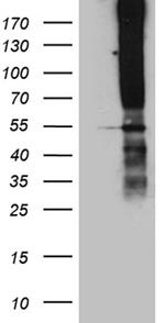 TSPAN7 Antibody in Western Blot (WB)