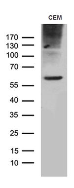 TSPAN7 Antibody in Western Blot (WB)
