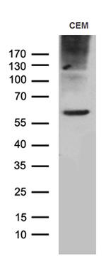 TSPAN7 Antibody in Western Blot (WB)