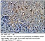 PBR Polyclonal Antibody