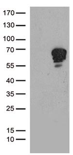 TSPYL1 Antibody in Western Blot (WB)