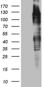 TTC14 Antibody in Western Blot (WB)
