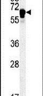 TTC26 Antibody in Western Blot (WB)