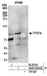 TTC7A Polyclonal Antibody