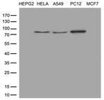 TTC7A Antibody in Western Blot (WB)