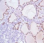 TTF1 Antibody in Immunohistochemistry (IHC)