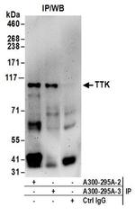 TTK Antibody in Western Blot (WB)