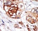 TTK Antibody in Immunohistochemistry (IHC)