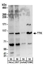 TTK Antibody in Western Blot (WB)