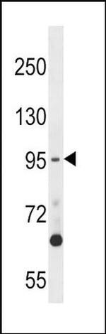 TTK Antibody in Western Blot (WB)