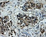 TTLL12 Antibody in Immunohistochemistry (Paraffin) (IHC (P))