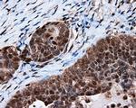 TTLL12 Antibody in Immunohistochemistry (Paraffin) (IHC (P))