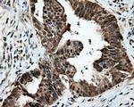 TTLL12 Antibody in Immunohistochemistry (Paraffin) (IHC (P))