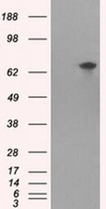 TTLL12 Antibody in Western Blot (WB)
