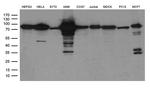TTLL12 Antibody in Western Blot (WB)