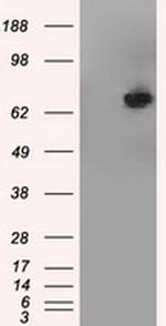 TTLL12 Antibody in Western Blot (WB)