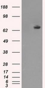 TTLL12 Antibody in Western Blot (WB)
