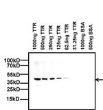 TTR Monoclonal Antibody (2E10C5)