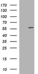 TUBA1C Antibody in Western Blot (WB)