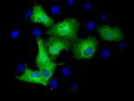 TUBA3E Antibody in Immunocytochemistry (ICC/IF)
