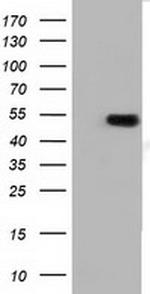 TUBA3E Antibody in Western Blot (WB)