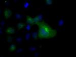 TUBA8 Antibody in Immunocytochemistry (ICC/IF)