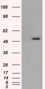 TUBA8 Antibody in Western Blot (WB)