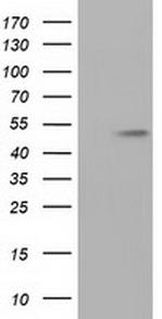 TUBA8 Antibody in Western Blot (WB)