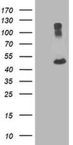 TUBA8 Antibody in Western Blot (WB)