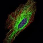 TUBA8 Antibody in Immunocytochemistry (ICC/IF)