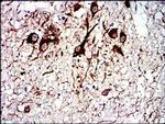 TUBA8 Antibody in Immunohistochemistry (Paraffin) (IHC (P))