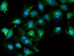 TUBAL3 Antibody in Immunocytochemistry (ICC/IF)