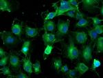 TUBAL3 Antibody in Immunocytochemistry (ICC/IF)