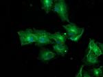 TUBAL3 Antibody in Immunocytochemistry (ICC/IF)