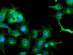 TUBAL3 Antibody in Immunocytochemistry (ICC/IF)