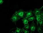 TUBAL3 Antibody in Immunocytochemistry (ICC/IF)