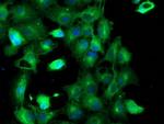 TUBAL3 Antibody in Immunocytochemistry (ICC/IF)