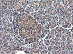 TUBAL3 Antibody in Immunohistochemistry (Paraffin) (IHC (P))