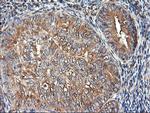TUBAL3 Antibody in Immunohistochemistry (Paraffin) (IHC (P))