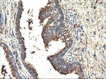 TUBAL3 Antibody in Immunohistochemistry (Paraffin) (IHC (P))