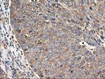 TUBAL3 Antibody in Immunohistochemistry (Paraffin) (IHC (P))