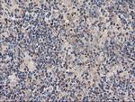 TUBAL3 Antibody in Immunohistochemistry (Paraffin) (IHC (P))