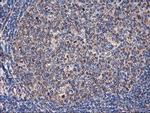 TUBAL3 Antibody in Immunohistochemistry (Paraffin) (IHC (P))