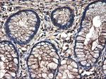 TUBAL3 Antibody in Immunohistochemistry (Paraffin) (IHC (P))
