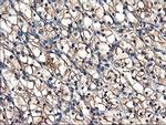 TUBAL3 Antibody in Immunohistochemistry (Paraffin) (IHC (P))