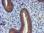 TUBAL3 Antibody in Immunohistochemistry (Paraffin) (IHC (P))