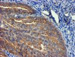 TUBAL3 Antibody in Immunohistochemistry (Paraffin) (IHC (P))