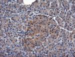 TUBAL3 Antibody in Immunohistochemistry (Paraffin) (IHC (P))